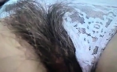 hair-lich6